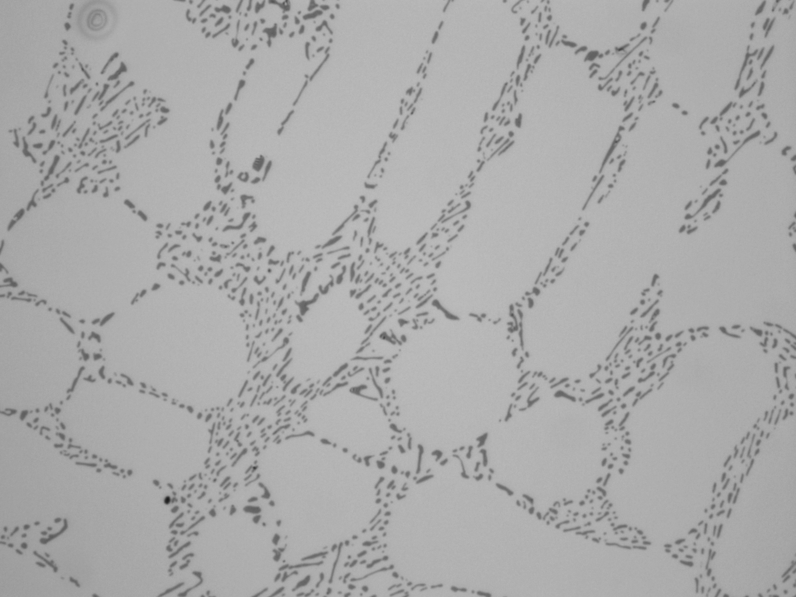 Al-Si合金のミクロ組織